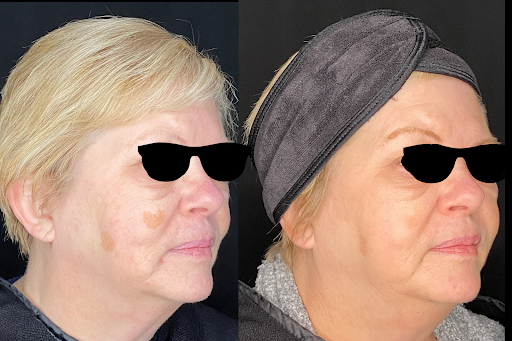 Explore cherubim tattoo ideas, creative tattoo ideas in Brookfield, available at Milwaukee Laser & Body Aesthetics