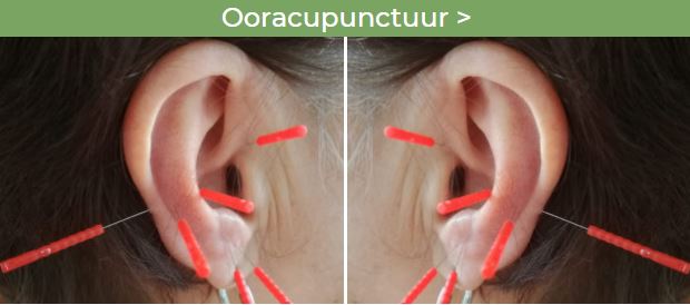 Ooracupunctuur - Chinese kruidentherapie - Bergen