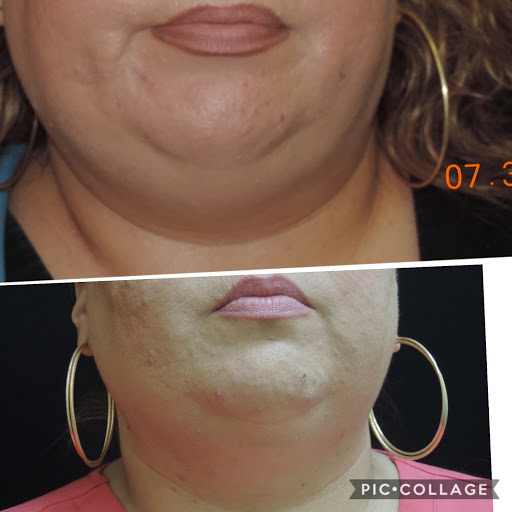 Medical Spa «New Image Medical Spa», reviews and photos, 680 Mowry Ave, Fremont, CA 94536, USA