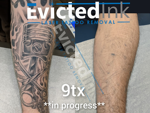 Explore how to think of a tattoo idea, creative tattoo ideas in Wichita, available at Evicted Ink Laser Tattoo Removal