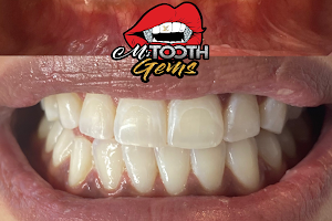M’s Tooth Gems image