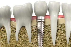 EneDent Premium Dental Clinic image