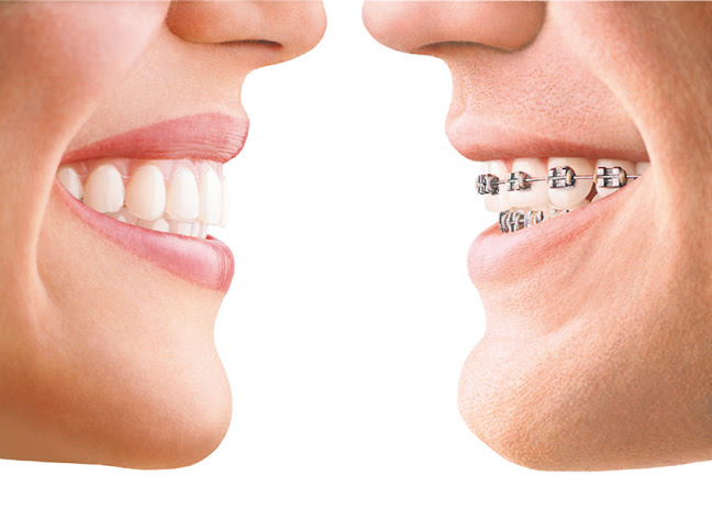 Opinii despre Spring Dental - Clinica de Ortodontie si Stomatologie Generala în <nil> - Dentist