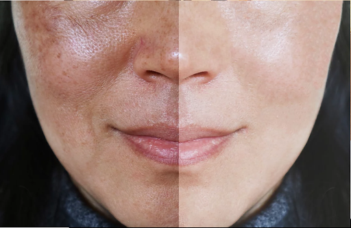 Explore eternal sunshine of the spotless mind tattoo ideas, creative tattoo ideas in Glenwood Springs, available at Lifestyle Laser