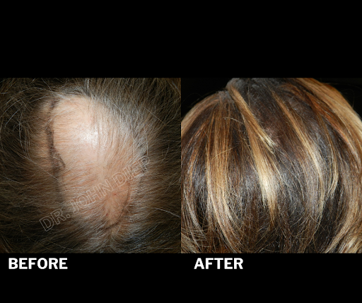 Medical Hair Transplant & Aesthetics image