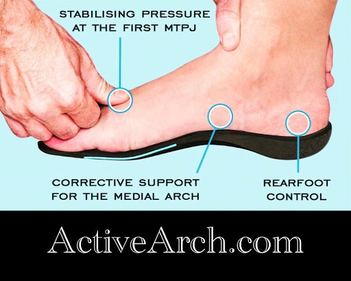 Orthotics ( Custom Molded Foot Prescription Insoles Arch Support) - order online ActiveArch.com image 10