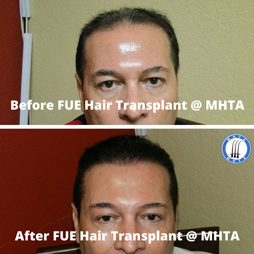 Medical Hair Transplant & Aesthetics image