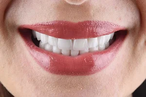 Creative Smiles Turkey (CS) Dental Clinic image