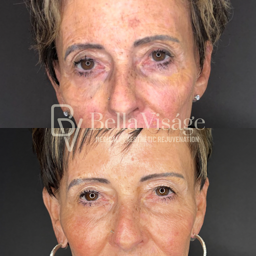 Explore new tattoo ideas for men, creative tattoo ideas in Lakeland, available at Bella Visge Medical & Aesthetic Rejuvenation