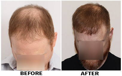 ForHair NYC Restoration Clinic - Dr. John Cole