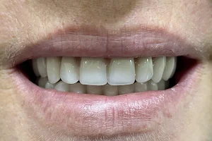 Özel Dent Seferihisar Ağız ve Diş Sağlığı Polikliniği - Dt. Hüseyin Anıl Banazlı - Dt. Muhittin Barış Doktaş image