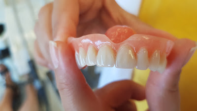 Laboratoire de Prothèse Dentaire AC DENT à Toulon