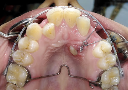 سمايلي كلينيك لطب و تقويم الاسنان ـ اسيوط smily dental clinic