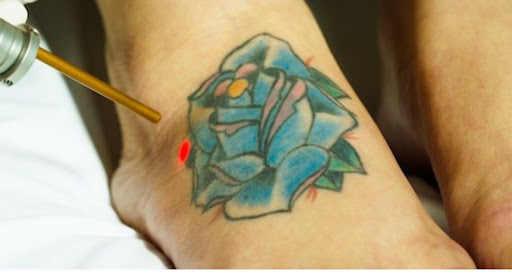 Explore palm sized tattoo ideas, creative tattoo ideas in Farmington, available at Zia Tattoo Removal LLC