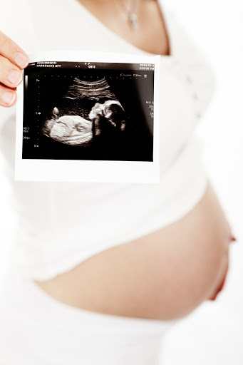 NoviBaby - Pregnancy Scans
