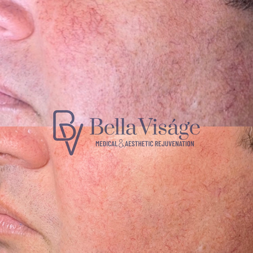 Explore stillbirth tattoo ideas, creative tattoo ideas in Lakeland, available at Bella Visge Medical & Aesthetic Rejuvenation