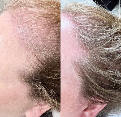 Explore zelda tattoo ideas, creative tattoo ideas in Vancouver, available at All You Aesthetics and Permanent Cosmetics