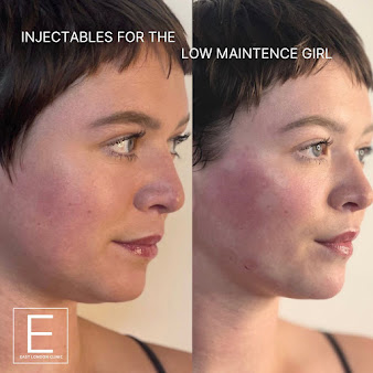 جماليات لندن المملكة المتحدة - Aesthetics London UK