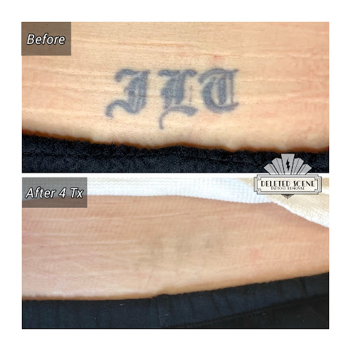 Explore flower wrist tattoo ideas, creative tattoo ideas in Hatboro, available at Deleted Scene Tattoo Removal