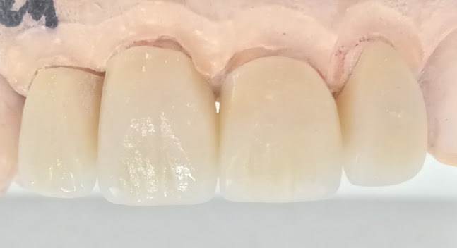 Opinii despre MundOral Consultorio dental în San Miguel - Dentista