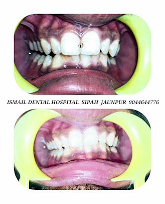 Ismail Dental Hospital and Research Center - Ismail Dental Hospital and Research Center