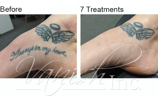 Explore sub tattoo ideas, creative tattoo ideas in Williamsport, available at Vanish Laser & Skin, Inc.