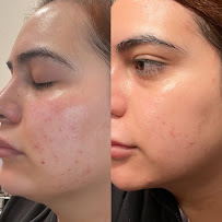 RebirthBeauty Bar - Photo 9 - Car repair in Baldwin Park, CA, West Covina