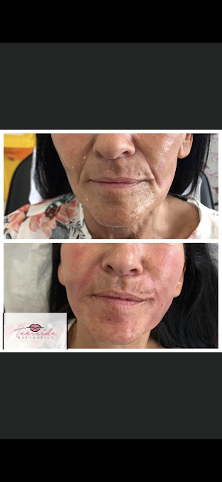 Teesside Aesthetics - Teesside Aesthetics