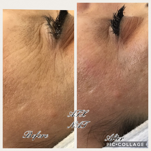 Explore black cover up tattoo ideas, creative tattoo ideas in Middle Village, available at Bye Bye Ink Laser Tattoo Removal