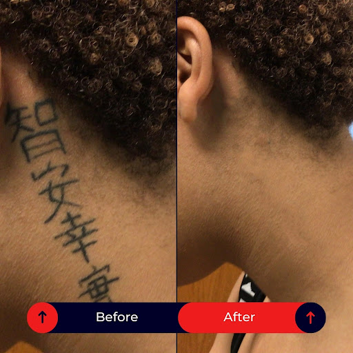 Explore facial tattoo ideas, creative tattoo ideas in Covington, available at The Laser Magic Tattoo Removal