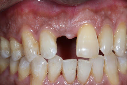 Malik dental clinic and implant center - Malik dental clinic and implant center