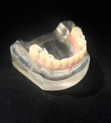 Santa Rosa Dental - Prosthodontics