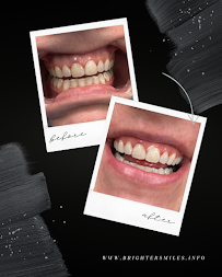 Brighter Smiles & Beauty - Photo 9 - Car repair in Bloomington, IL, Bloomington