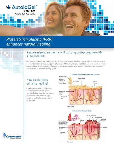 Hair Replacement Service «Hair Restoration Center of Utah», reviews and photos, 2104 Fort Union Blvd, Salt Lake City, UT 84121, USA