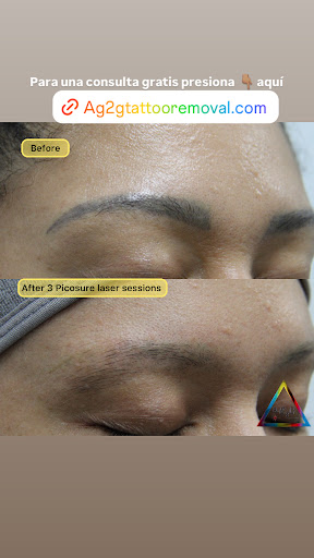 Explore paramedic tattoo ideas, creative tattoo ideas in New York, available at Ag2g Laser Tattoo Removal & MedSpa