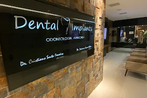 Dental Implants image