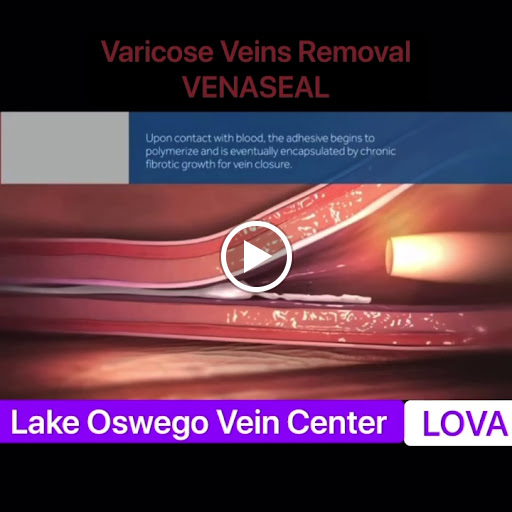 Explore see no evil tattoo ideas, creative tattoo ideas in Lake Oswego, available at Lake Oswego Vein and Aesthetic LOVA