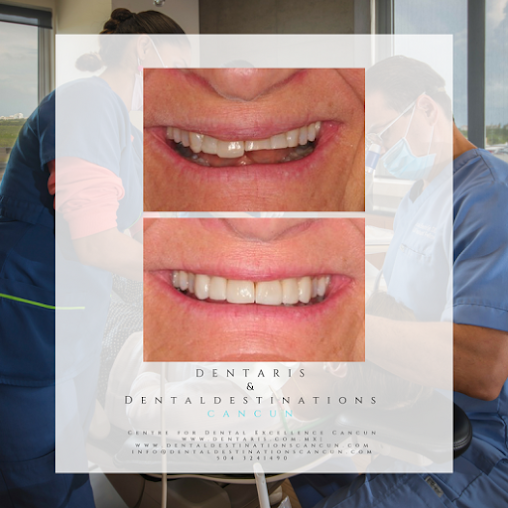 MEDIKO Dental Cancun - MEDIKO Dental Cancun