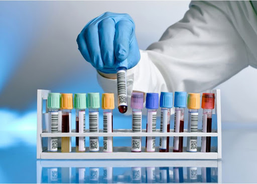 Panacea Blood Sample Collection Diagnostic (Heavy Discount on Blood Test with quality reports)