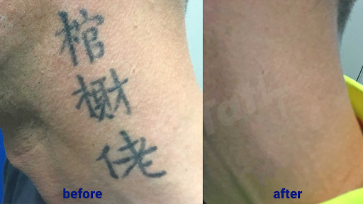 Explore date tattoo ideas, creative tattoo ideas in Sheffield Lake, available at TakeTatt Tattoo Removal