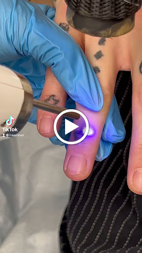 Explore blue rose tattoo ideas, creative tattoo ideas in Tucson, available at Allure Medical