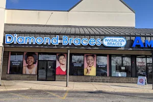 Diamond Braces Orthodontist: Braces & Invisalign image