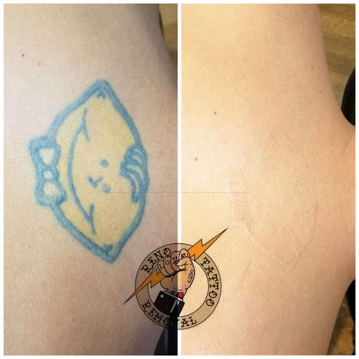 Find music symbol tattoo ideas for your next unique tattoo in Reno at Reno Tattoo Removal