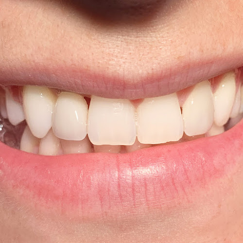 Dr. Tudor Cocerhan - Expert Implanturi dentare - <nil>