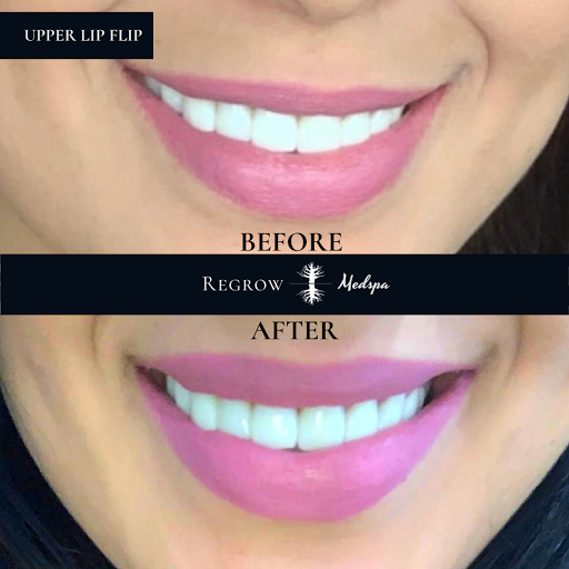 Explore tattoo of lips ideas, creative tattoo ideas in Davenport, available at Regrow Medspa