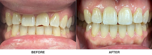 Encino Family Dental Cosmetic & Emergency Dentistry Encino Dr. Marian Yassa DDS. image