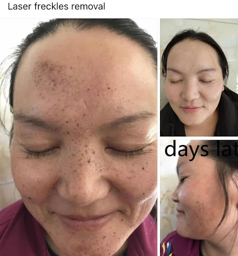 Explore cowboy up tattoo ideas, creative tattoo ideas in Tempe, available at Sparkle Laser HairTattoo Removal