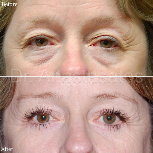 Los Angeles Plastic Surgery image