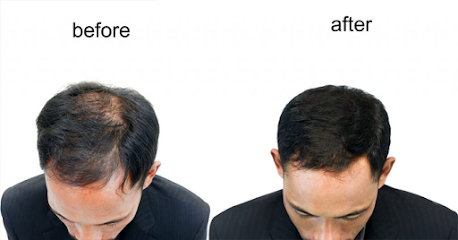 Robotic Hair Restoration of Long Island clinic