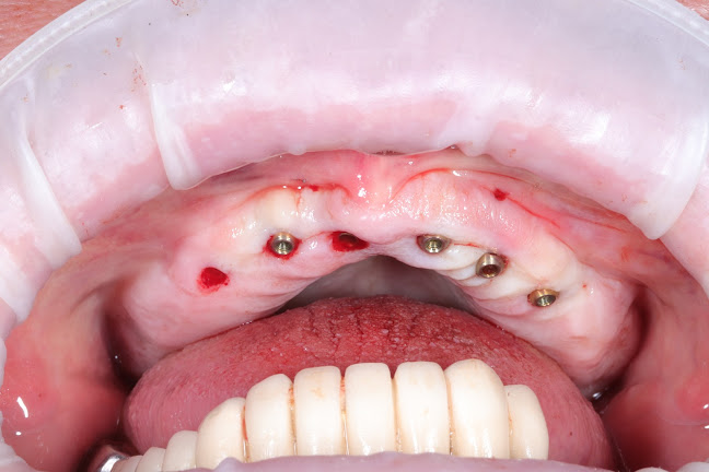 Opinii despre Medtic Dental Radauti în <nil> - Dentist
